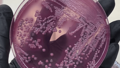 petri dish